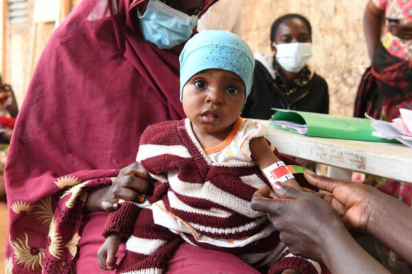 Urgent Action Needed to Holistically Address Child Malnutrition in West and Central Africa