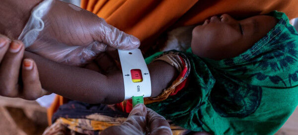 Horn Of Africa Faces Most ‘Catastrophic’ Food Insecurity in Decades, Warns WHO