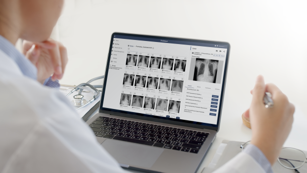 Promedius Inc. brings cutting-edge medical imaging AI cloud platform, AIdant to GITEX AFRICA 2023
