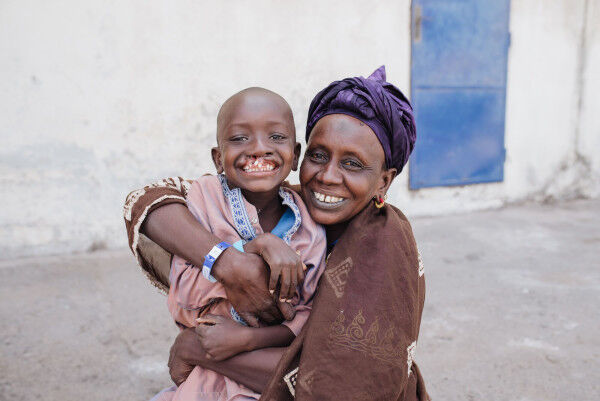Boy, four, able to start school with a smile, thanks to surgical charity