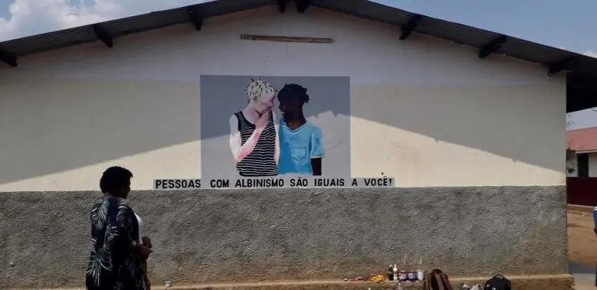 Breaking Educational Barriers for Children with Albinism