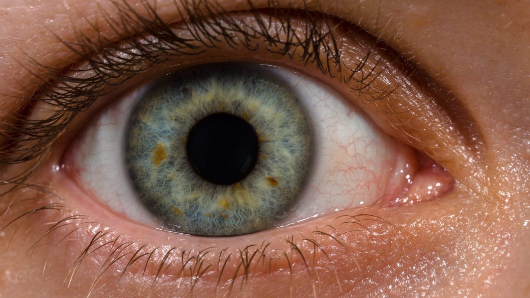 Eye Pix 2