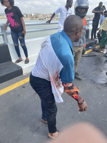 One person is reportedly missing while others were injured in an accident on Third Mainland Bridge