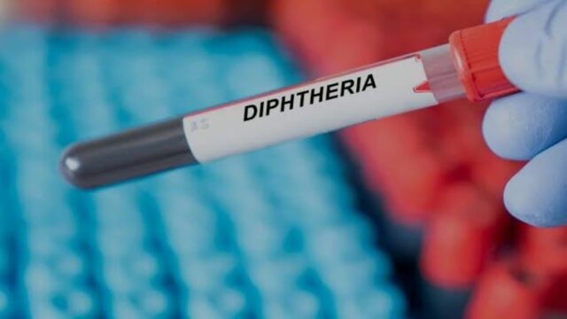 diphtheria_1600x900-1536×864.jpeg