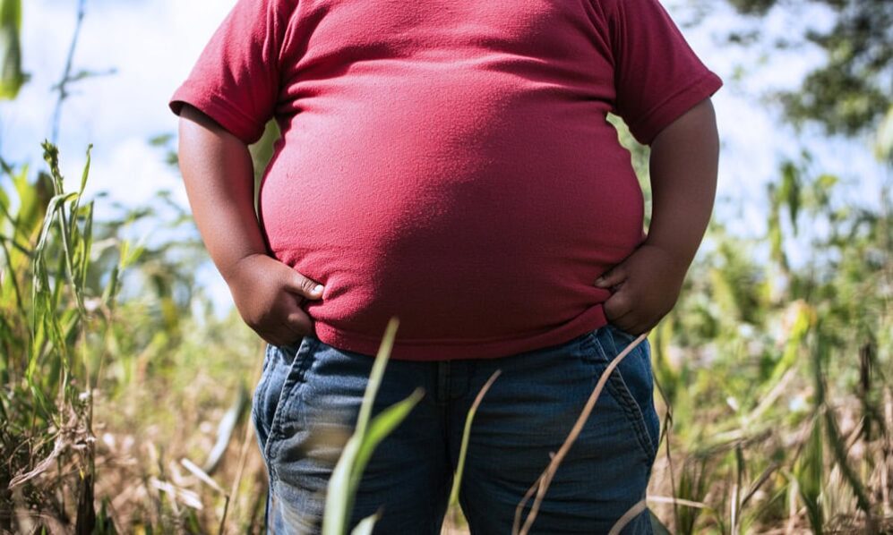 fat-obese-obesity-weightloss-1