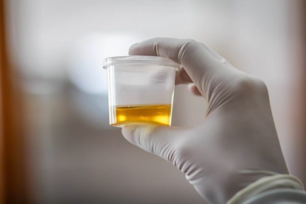 Photo: Urine-Military-Times
