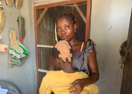 Survivor Calabar