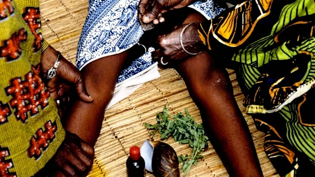 Female Genital Mutilation