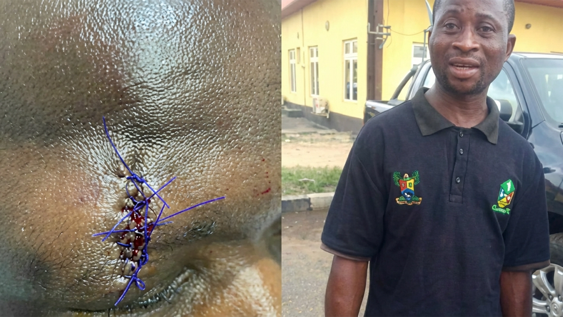 Some assaulted KAI officials