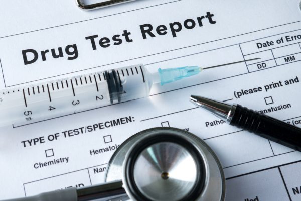 dope test