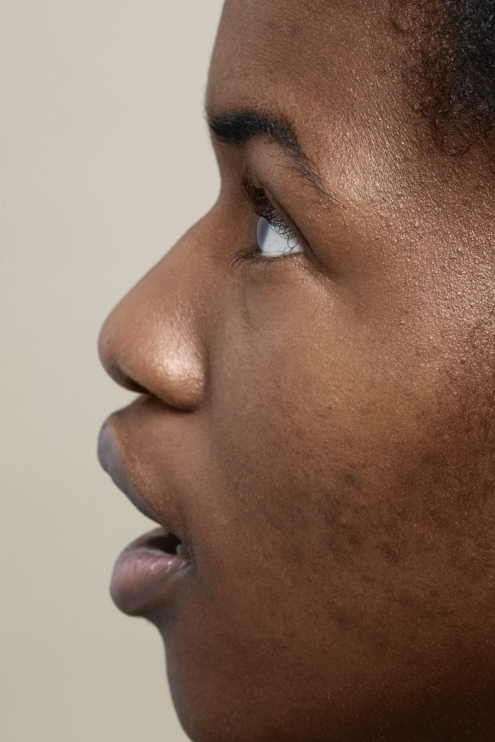 close-up-face-pores-texture. Photo by Freepik