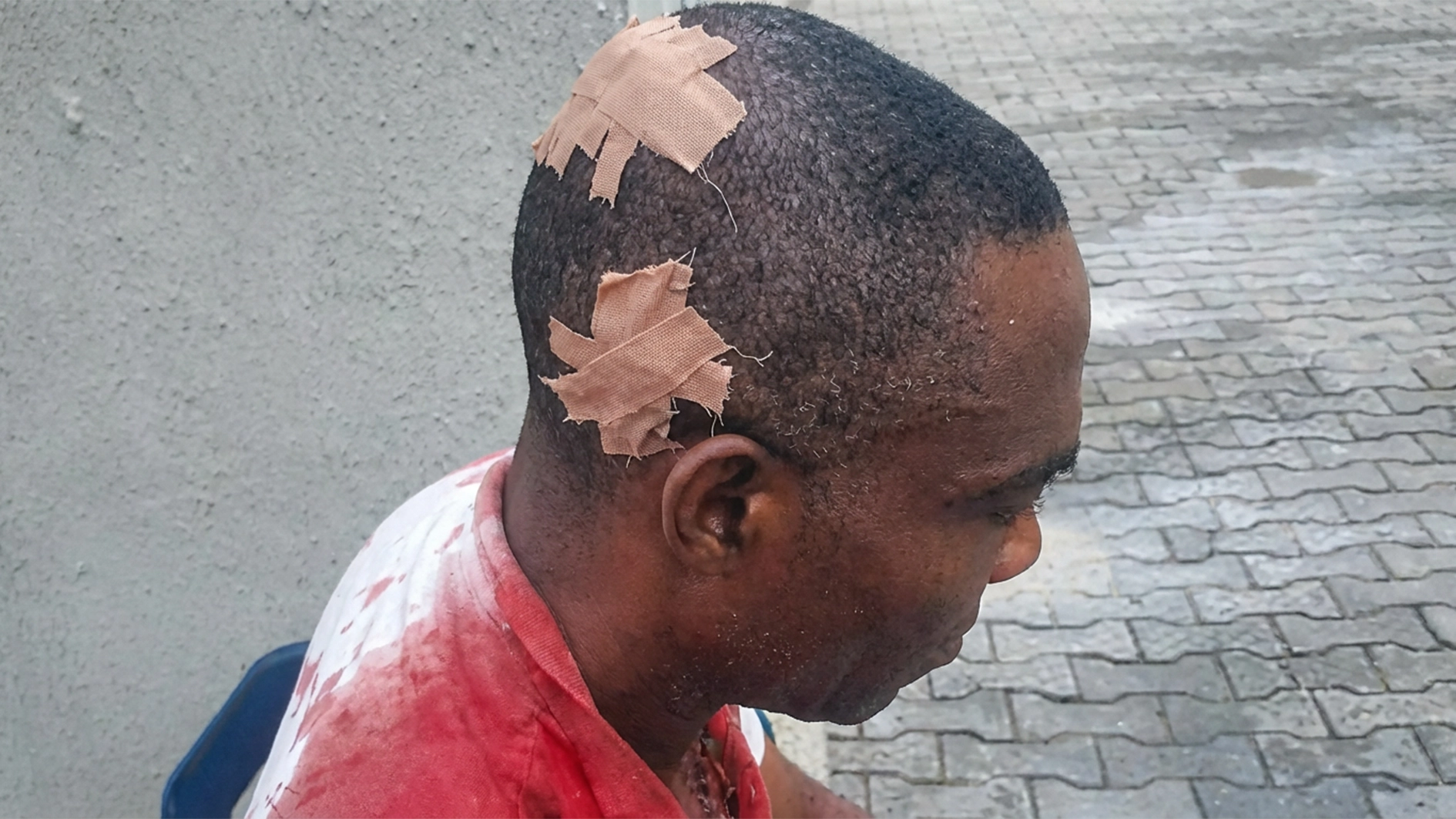 Pastor Chimezie after he was attacked