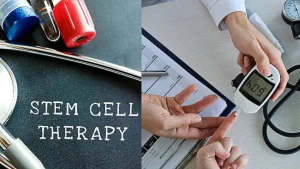 Stem Cell