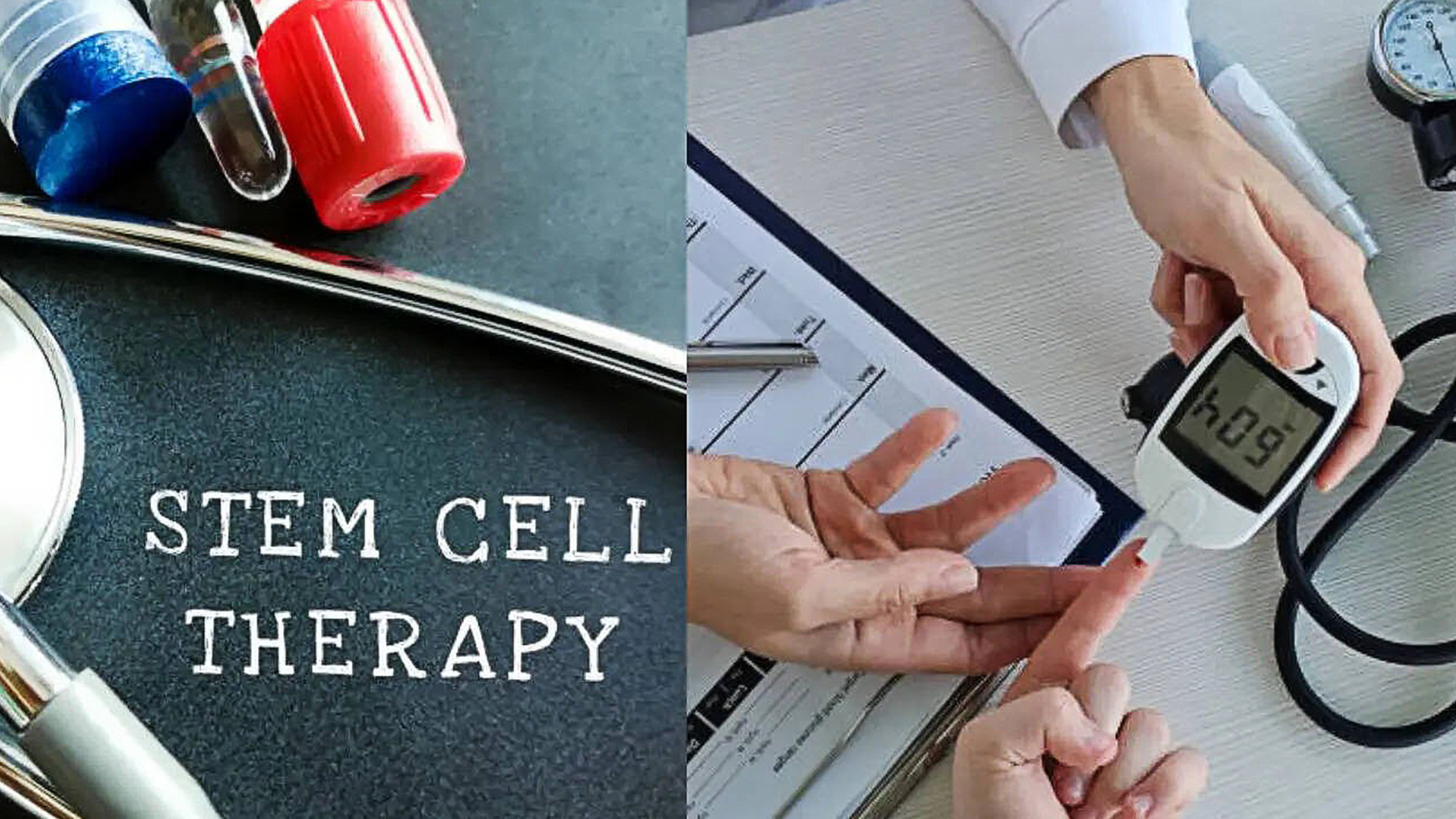 Stem Cell
