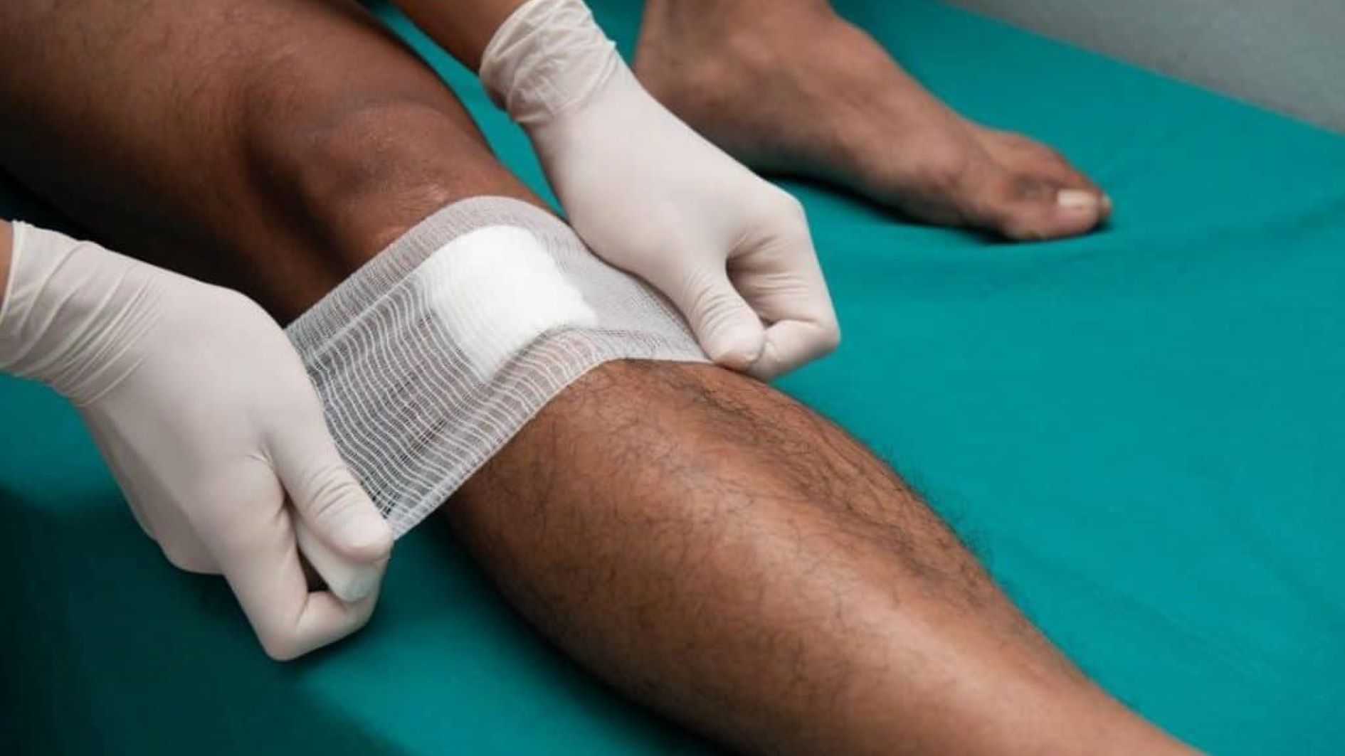 person-having-dressing-gauze-bandage-applied-to-open-wound-by-gloved-hands-1024×683