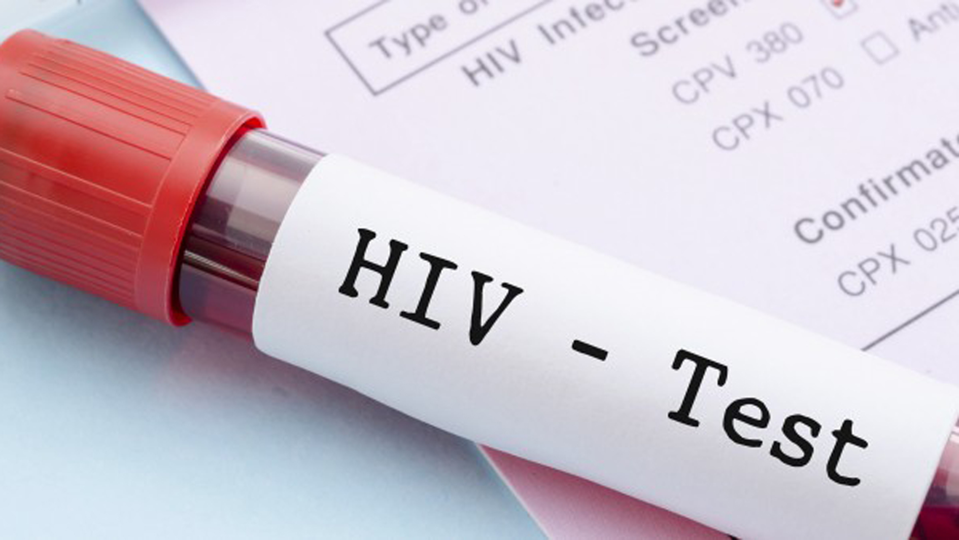 HIV testing