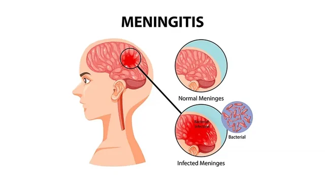 Meningitis