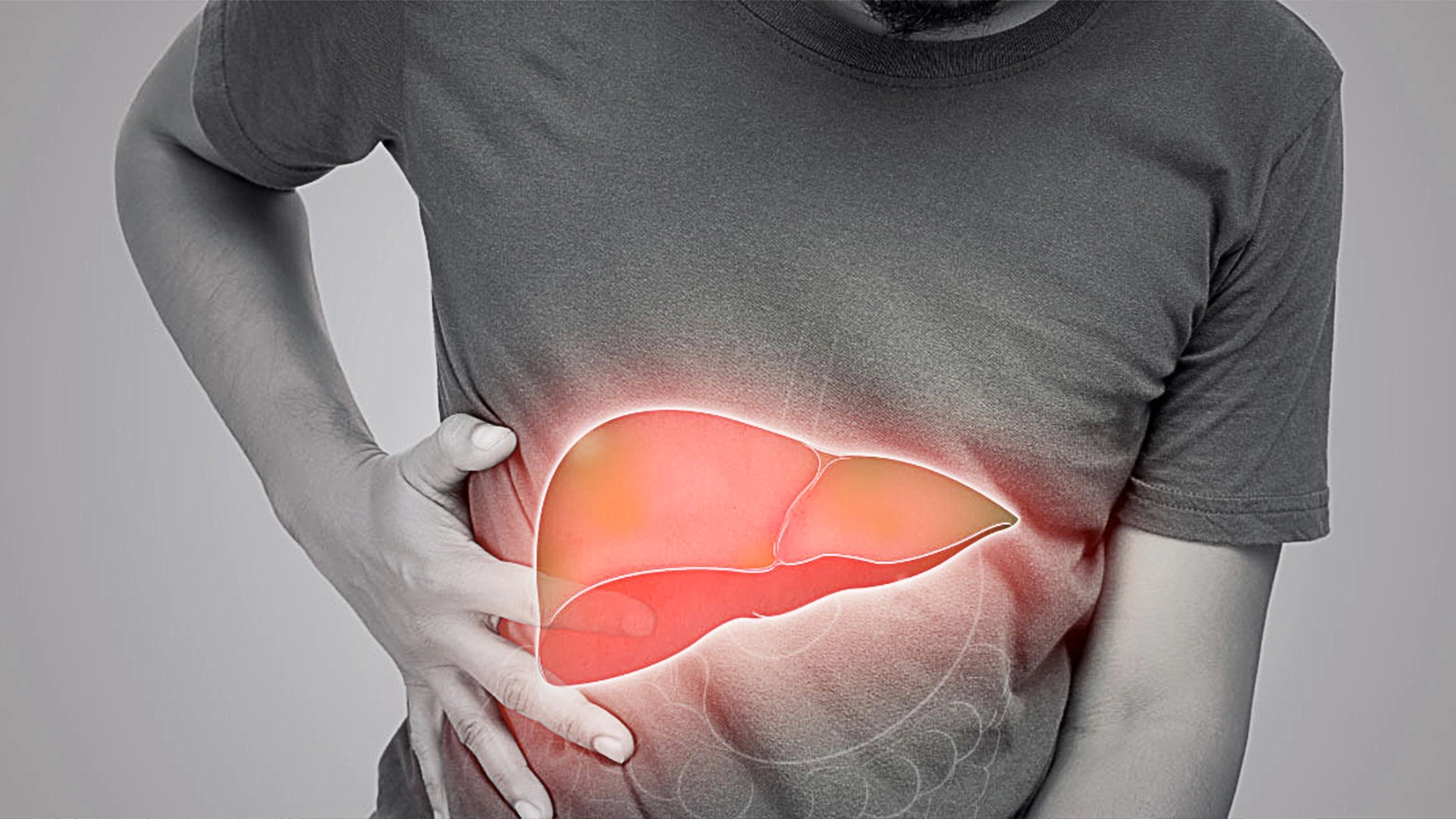 Hepatitis