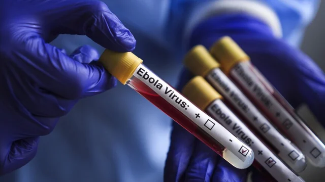 Ebola