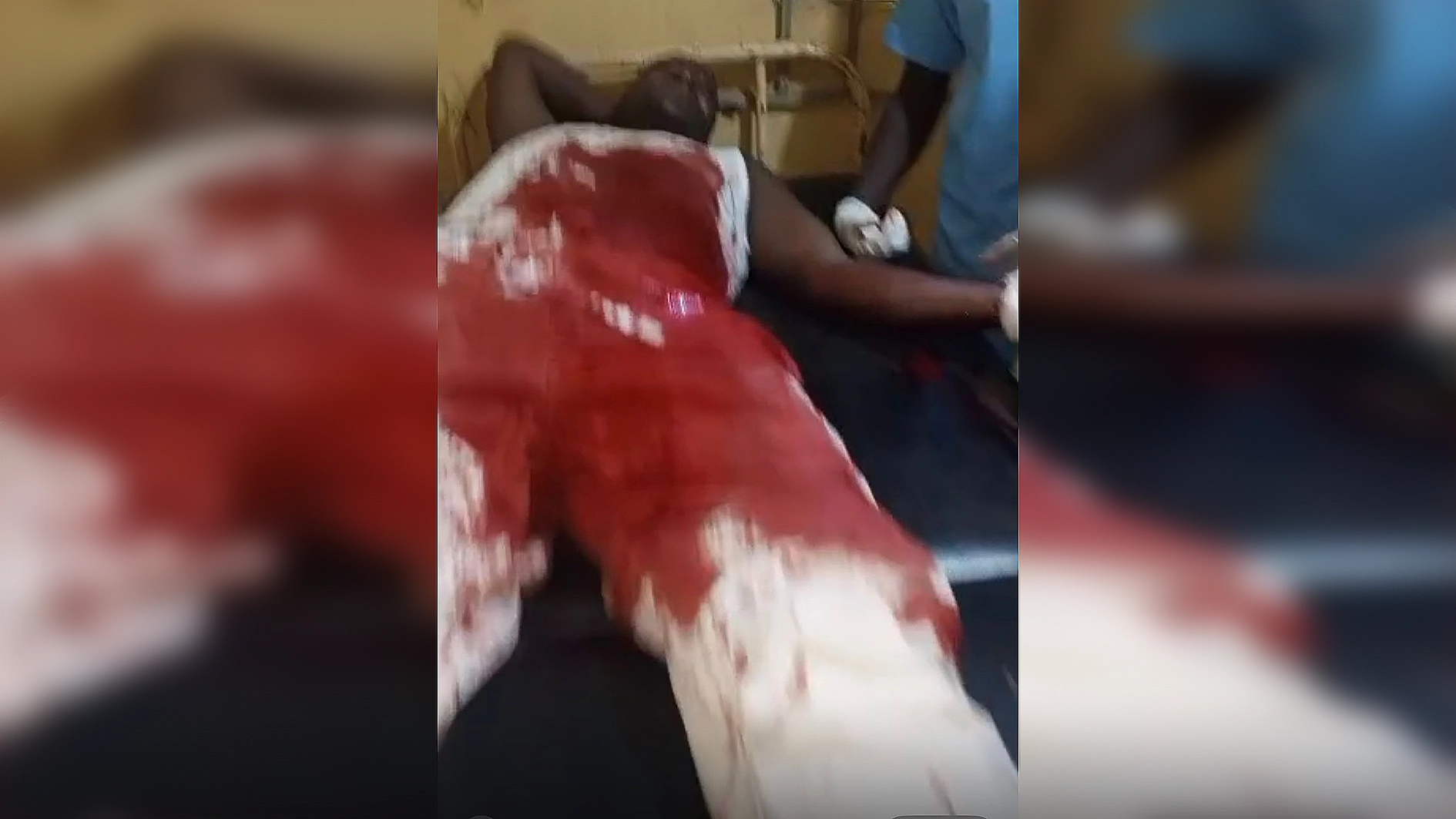 injured