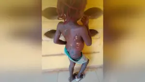 The rescued  victim