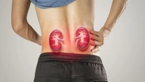 Kidney