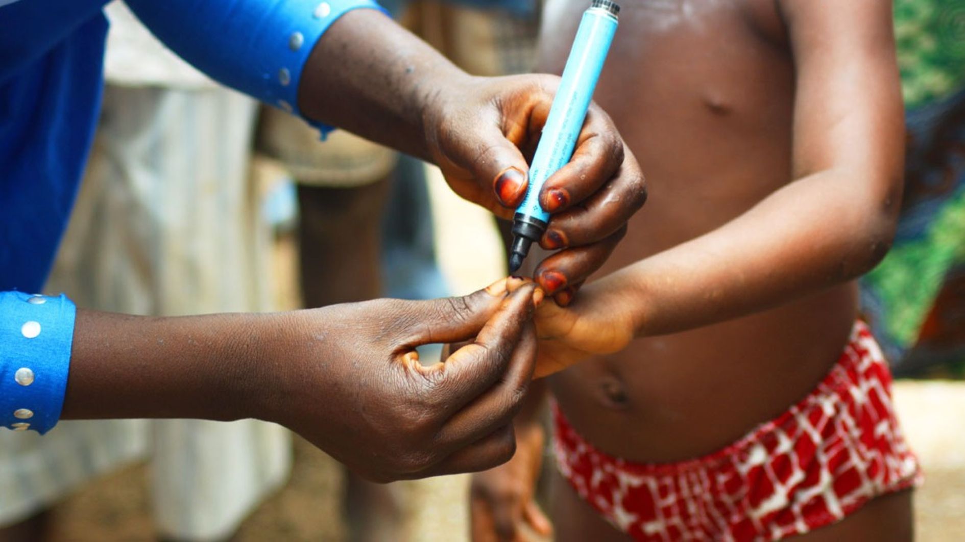 Polio